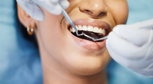 Best Emergency Tooth Extraction in Shepherd, TX