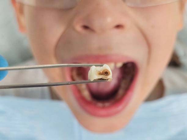Best Walk-In Emergency Dentist in Shepherd, TX
